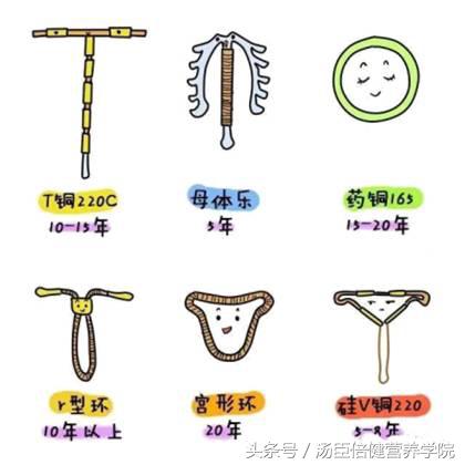 避孕措施只能上环吗,避孕可以采取哪几种措施