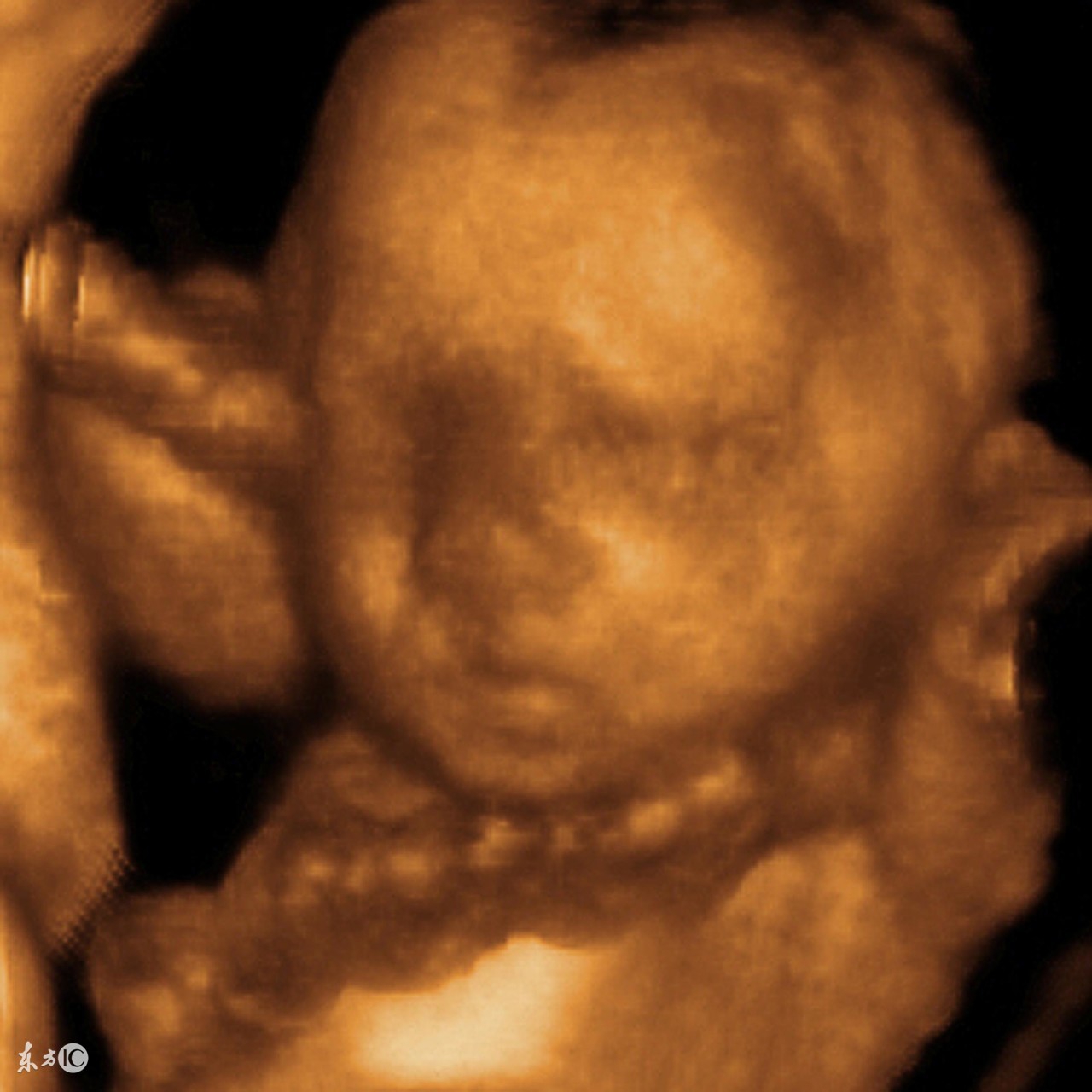 胎儿脐带绕颈要怎么才能绕回来,36周脐带绕颈2周后期能绕回来吗