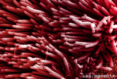 初期肺癌喝中药能消除吗,早期肺癌可以喝中药治愈吗