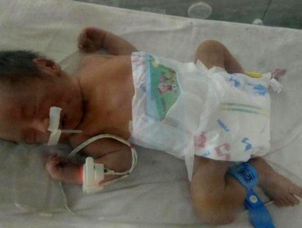 护士一时大意孕妇吃错药,护士疏忽婴儿死亡