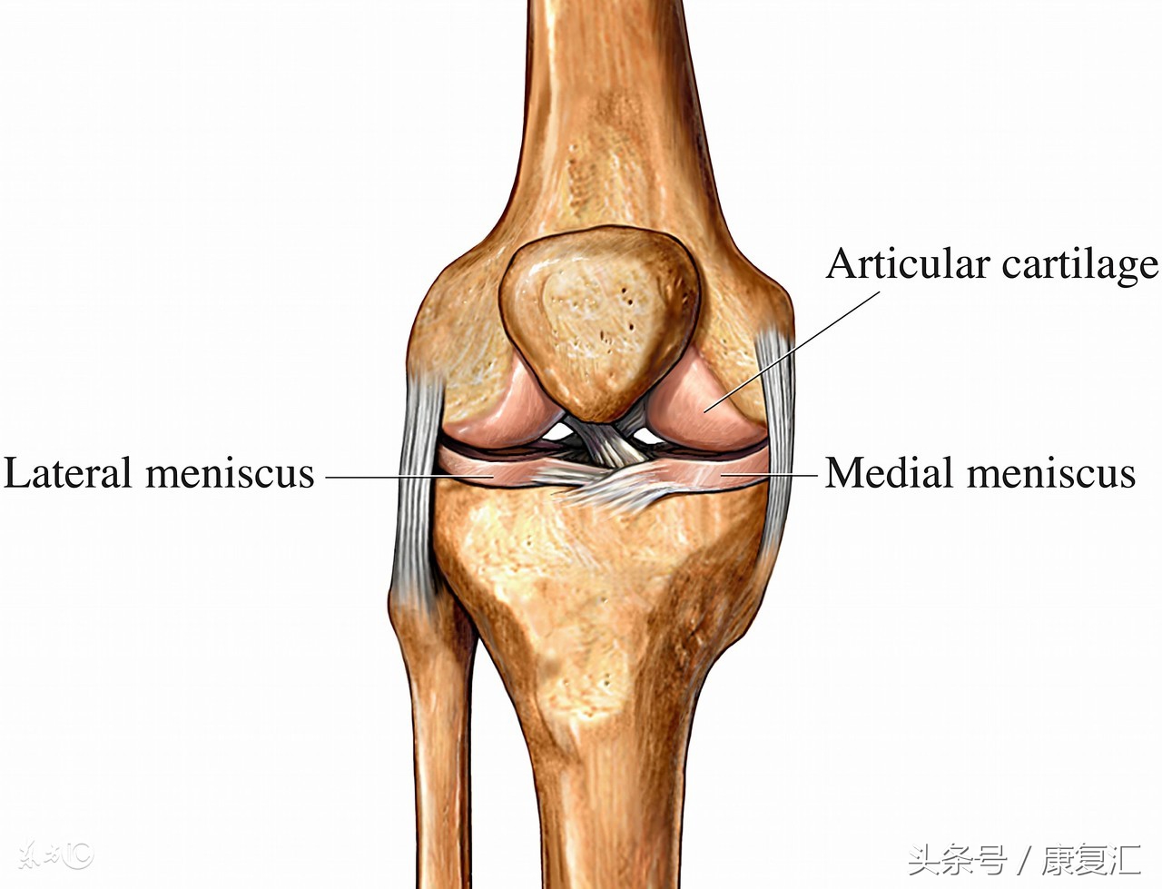 左膝关节内侧副韧带撕裂怎么锻炼,膝关节内侧副韧带损伤如何恢复