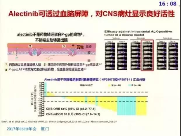 nsclc一线治疗新进展,nsclc精准治疗