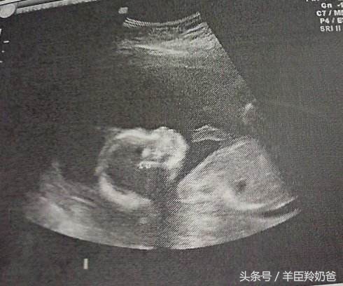 准妈妈怀孕几个月最好,准妈妈怀孕多长时间能感觉到胎动