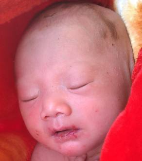 幼儿嘴里起红泡是怎么回事,宝宝嘴里刚开始白色皮后来变红色