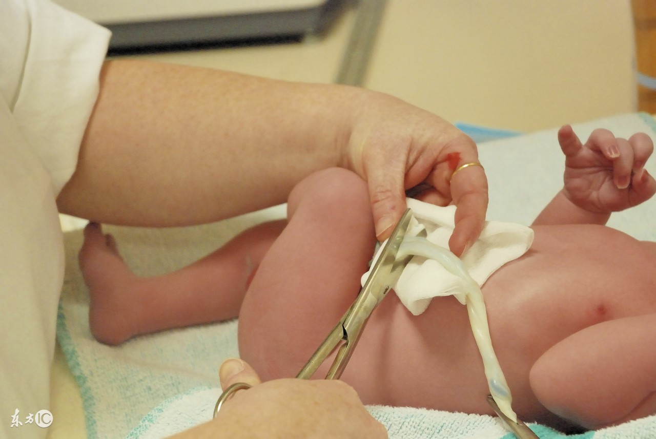 胎儿脐带绕颈要怎么才能绕回来,36周脐带绕颈2周后期能绕回来吗