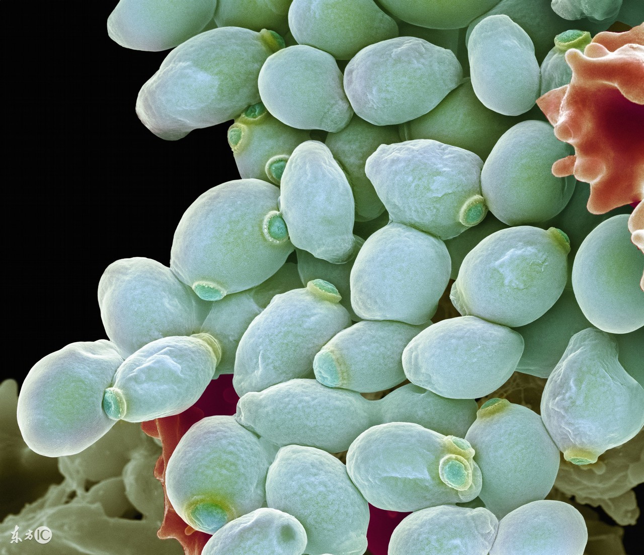 女人高危病有哪些,女人需要警惕四种病