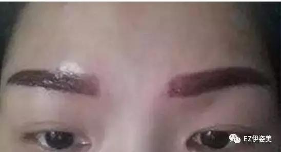 雾眉后期发红怎么处理,雾眉尾巴发红怎么回事