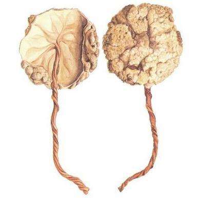 胎盘这样处理，对宝宝有大好处，妈妈都后悔知道的太晚了