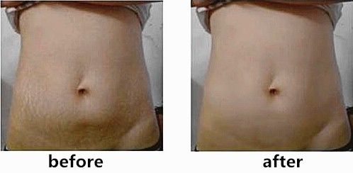 深扒热门贵妇面霜,深扒网红抗老成分真的这么有效吗