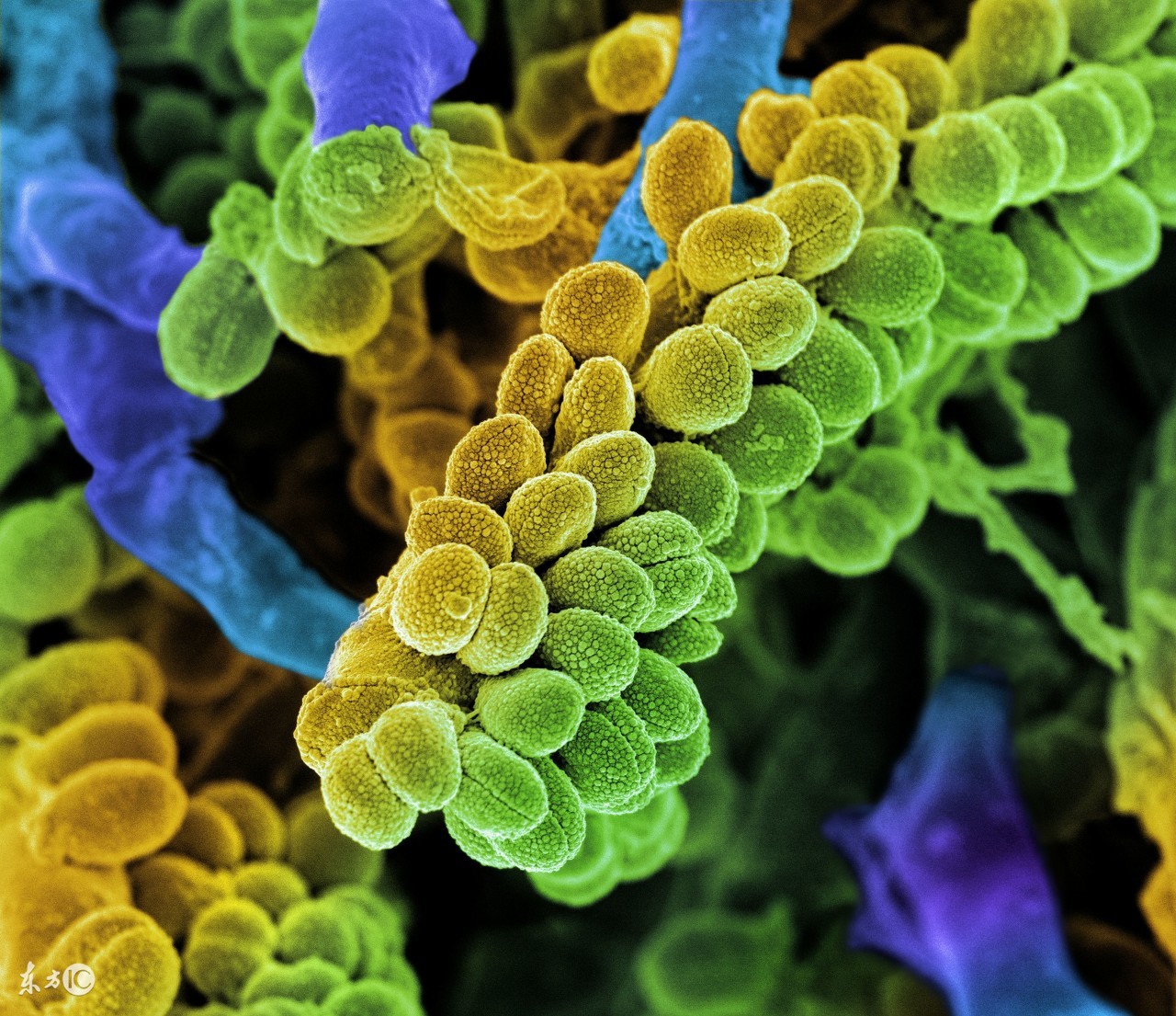 脱发怎么调理头发才能长出来不掉,脱发严重而且不长新的头发怎么办