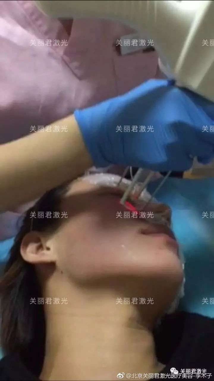 医学美白嫩肤方法,医生推荐的美白食疗方法