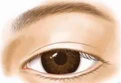 好看的双眼皮必须具备以下几点,真正做的好看的双眼皮是什么样子