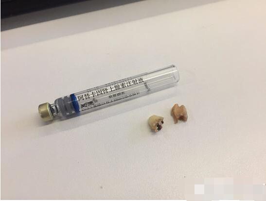 隔空给葛优拔牙:一直在红火,从未被超越!打假俱乐部:真幽默!