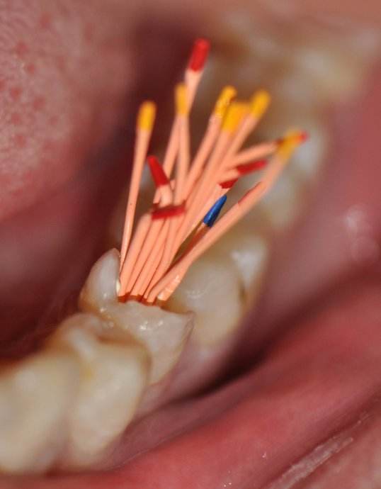 疼起来真的要人命,疼起来要人命上一句