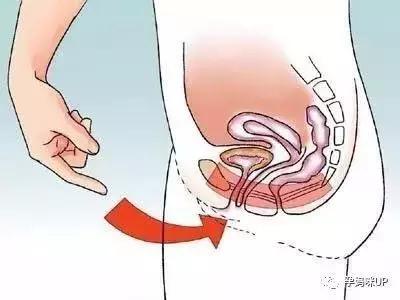 笑尿了是什么病态,笑尿了怎么办