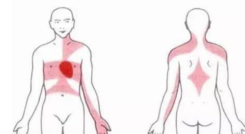 放射性痛是什么感觉,什么是放射性疼痛的症状