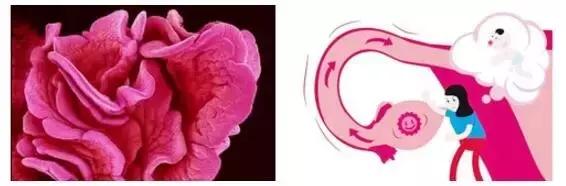 输卵管堵塞宫外孕后还敢怀孕吗,多囊加输卵管堵塞怀孕几率多大