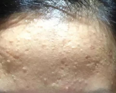 朵嘉浓到底能修复皮肤角质层吗,朵嘉浓祛痘