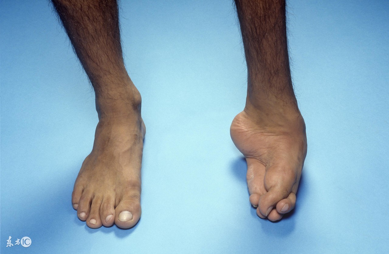 女人吃皮蛋有什么好处与坏处,皮蛋对肺结节肝囊肿有坏处吗