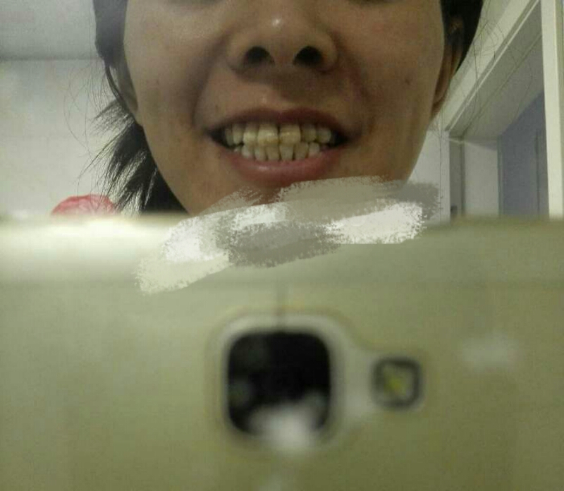 比较有效的牙齿美白方法,你需要知道的牙齿美白小窍门