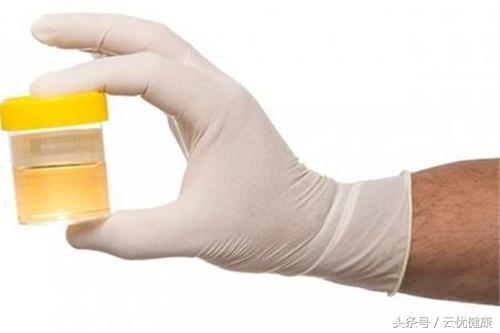 如何从尿液判断疾病,疾病数据哪里查询