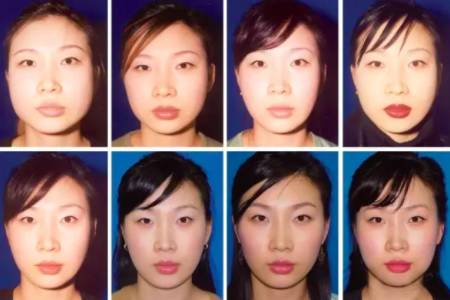 瘦脸针打后悔了怎么做能尽快恢复,瘦脸针人人都可以打吗科普篇