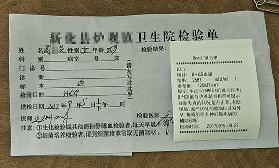 一胎顺利二胎怀不上是怎么回事,一胎很顺利二胎为什么反复不好