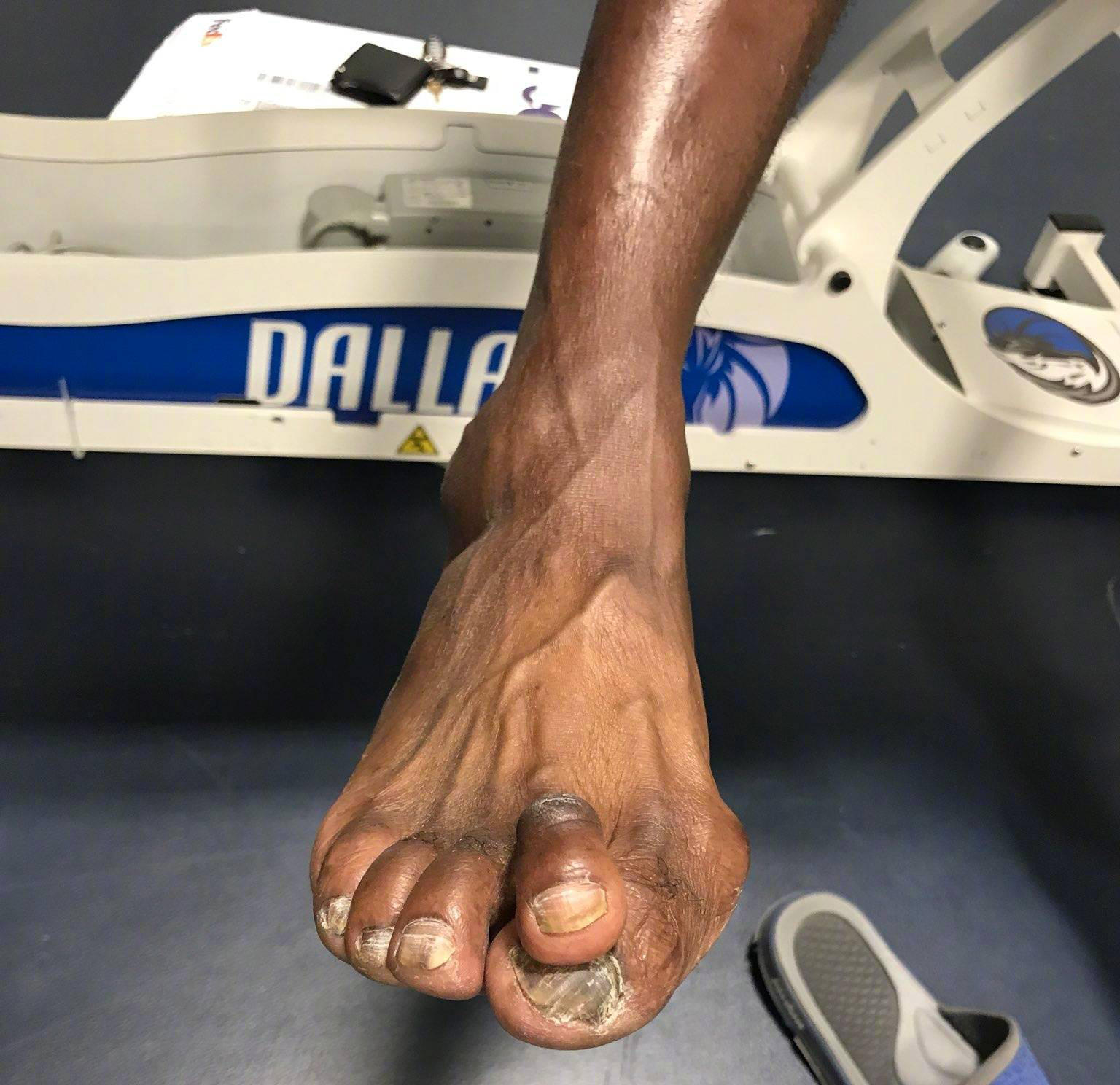 诺维茨基背影照,诺维茨基背影图片