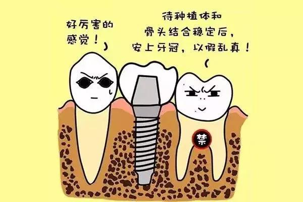 缺牙是种植牙还是烤瓷牙好,烤瓷牙和种植牙哪个保持时间长