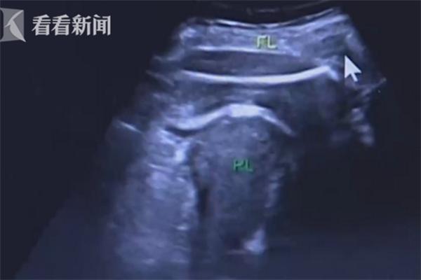 8个月胎儿踢妈妈视频,八个月的孕妇已经学会跆拳道