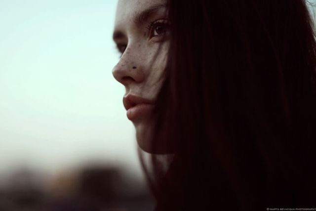 孕期妈妈皮肤变黑,孕晚期长褐斑