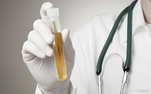 如何从尿液判断疾病,疾病数据哪里查询