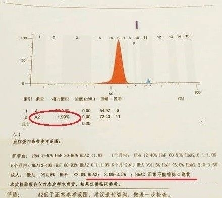 孕期甲减糖尿病地中海贫血,孕期地中海贫血症状和危害