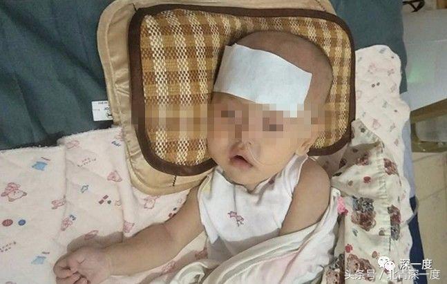 罕见病300万一年,300万一年的罕见病