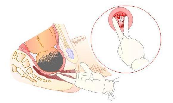 生孩子开十指有多痛,生孩子开十指有多可怕