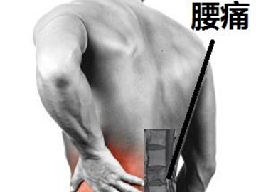 腰椎管狭窄症典型的临床症状是,腰椎管狭窄压迫神经症状有哪些