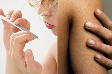 指甲不平有纹是怎么改善,指甲不光滑凹凸不平有哪些图片