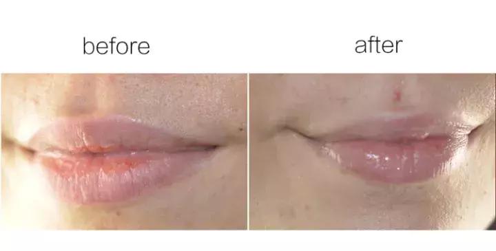 唇膏推荐6-12岁颜值高,让嘴唇红润的润唇膏推荐