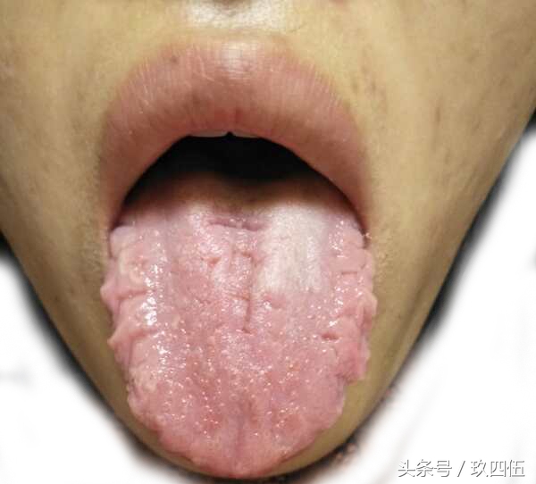 手脚冰凉怕冷身体疲倦,手脚冰凉怕冷一招搞定