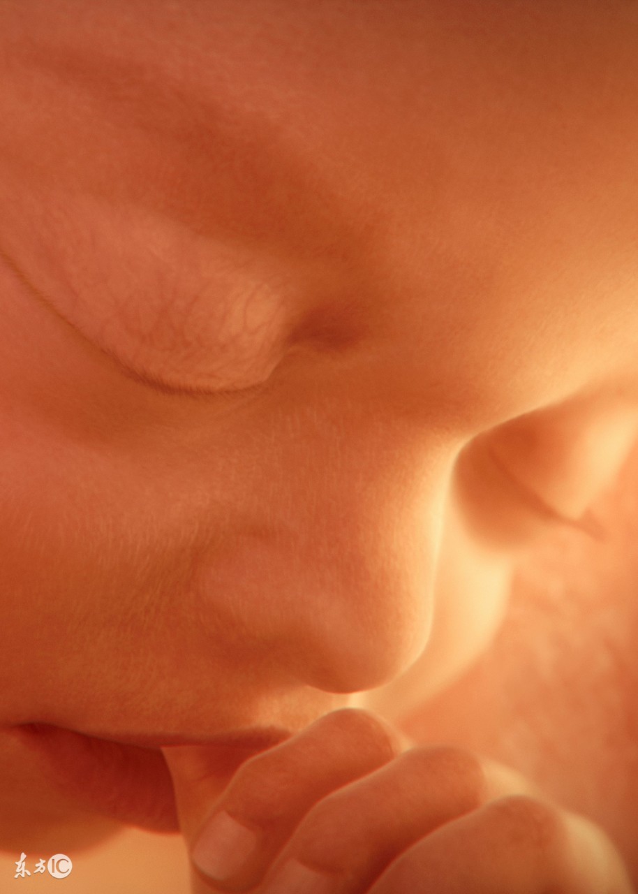 胎儿心包积液能生吗,胎儿胸腔积液可以生吗