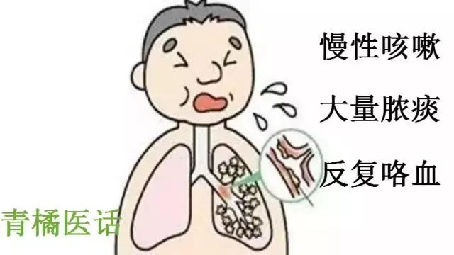 中医观病│天气稍一变化,就开始咳嗽,黛玉妹妹究竟是什么病?