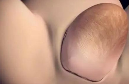 胎儿那么大怎么生出来,顺产胎儿怎么从产道出来