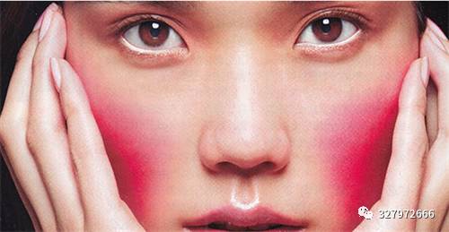 朵嘉浓修复红血丝吗,朵嘉浓为什么会长痘痘