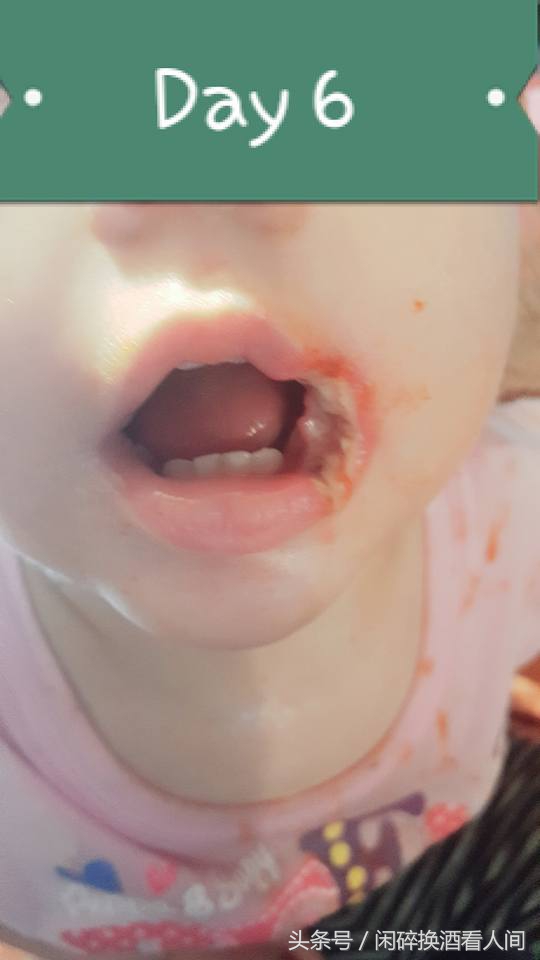 儿童接触手机充电器事故,儿童充电器事故视频