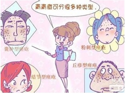 爱美的你，还在为讨厌的青春痘烦恼吗？小编和你一起战“痘”到底