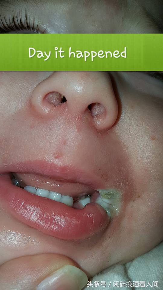 儿童接触手机充电器事故,儿童充电器事故视频