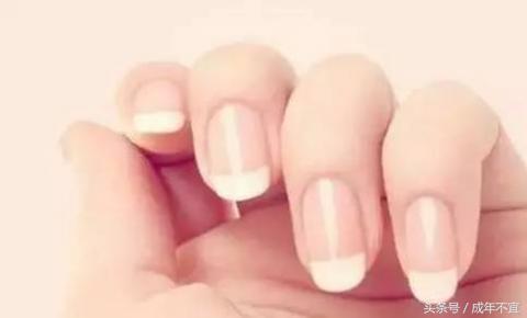手指半月牙正常图片,手指没有半月牙是怎么回事
