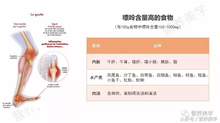高尿酸血症饮食指南,高尿酸血症的饮食一览表