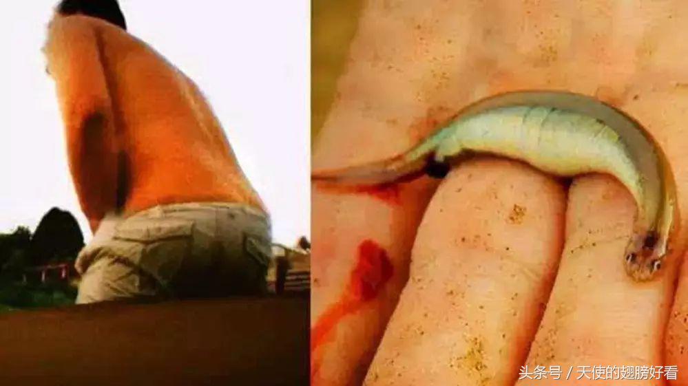 会钻入体内啃食的鱼类,吸食人类身体的鱼