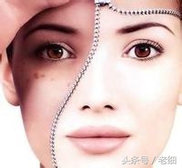 脸上有斑怎么调理呢,教你一个办法!